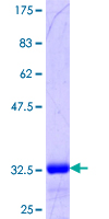 ab163294 on a 12.5% SDS-PAGE stained with Coomassie Blue.