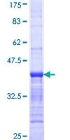 ab160988 on a 12.5% SDS-PAGE stained with Coomassie Blue.