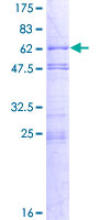 ab162415 on a 12.5% SDS-PAGE stained with Coomassie Blue.