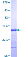 ab159215 on a 12.5% SDS-PAGE stained with Coomassie Blue.