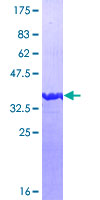 ab161102 on a 12.5% SDS-PAGE stained with Coomassie Blue.