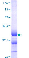 ab158017 on a 12.5% SDS-PAGE stained with Coomassie Blue.