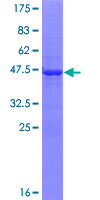 ab166562 on a 12.5% SDS-PAGE stained with Coomassie Blue.