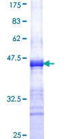 ab158103 on a 12.5% SDS-PAGE stained with Coomassie Blue.