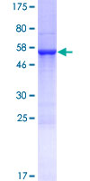 ab164563 on a 12.5% SDS-PAGE stained with Coomassie Blue.