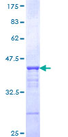 ab152273 on a 12.5% SDS-PAGE stained with Coomassie Blue.