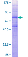 ab158147 on a 12.5% SDS-PAGE stained with Coomassie Blue.