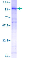 ab158108 on a 12.5% SDS-PAGE stained with Coomassie Blue.