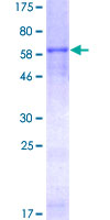 ab152274 on a 12.5% SDS-PAGE stained with Coomassie Blue.