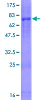 12.5% SDS-PAGE showing ab116981 at approximately 77.33kDa. Stained with Coomassie Blue.