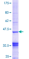 12.5% SDS-PAGE showing ab116982 at approximately 37.73kDa. Stained with Coomassie Blue.