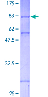 ab158106 on a 12.5% SDS-PAGE stained with Coomassie Blue.
