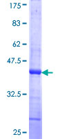 ab158107 on a 12.5% SDS-PAGE stained with Coomassie Blue.