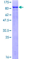 ab153166 on a 12.5% SDS-PAGE stained with Coomassie Blue.