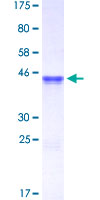 ab153167 on a 12.5% SDS-PAGE stained with Coomassie Blue.