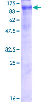 ab158134 on a 12.5% SDS-PAGE stained with Coomassie Blue.