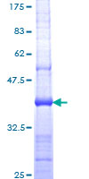 ab158135 on a 12.5% SDS-PAGE stained with Coomassie Blue.
