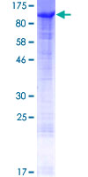 ab158110 on a 12.5% SDS-PAGE stained with Coomassie Blue.