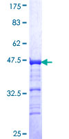 ab158111 on a 12.5% SDS-PAGE stained with Coomassie Blue.