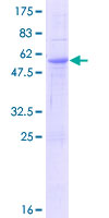 ab165461 on a 12.5% SDS-PAGE stained with Coomassie Blue.