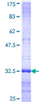ab165462 on a 12.5% SDS-PAGE stained with Coomassie Blue.