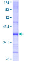 ab152275 on a 12.5% SDS-PAGE stained with Coomassie Blue.