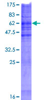 ab163457 on a 12.5% SDS-PAGE stained with Coomassie Blue.