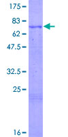 ab164881 on a 12.5% SDS-PAGE stained with Coomassie Blue.