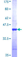 ab164882 on a 12.5% SDS-PAGE stained with Coomassie Blue.