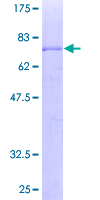 ab163098 on a 12.5% SDS-PAGE stained with Coomassie Blue.
