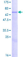 ab163099 on a 12.5% SDS-PAGE stained with Coomassie Blue.