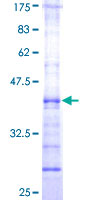 ab163100 on a 12.5% SDS-PAGE stained with Coomassie Blue.