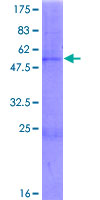 ab165779 on a 12.5% SDS-PAGE stained with Coomassie Blue.