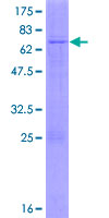 ab164997 on a 12.5% SDS-PAGE stained with Coomassie Blue.