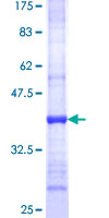 ab160485 on a 12.5% SDS-PAGE stained with Coomassie Blue.