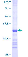 ab160502 on a 12.5% SDS-PAGE stained with Coomassie Blue.