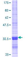 ab161691 on a 12.5% SDS-PAGE stained with Coomassie Blue.