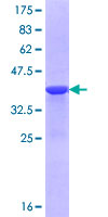 ab161443 on a 12.5% SDS-PAGE stained with Coomassie Blue.