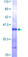 ab158232 on a 12.5% SDS-PAGE stained with Coomassie Blue.