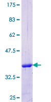 ab153478 on a 12.5% SDS-PAGE stained with Coomassie Blue.