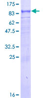 ab161141 on a 12.5% SDS-PAGE stained with Coomassie Blue.