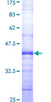 ab161142 on a 12.5% SDS-PAGE stained with Coomassie Blue.