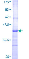 ab160049 on a 12.5% SDS-PAGE stained with Coomassie Blue.