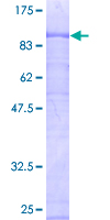ab164690 on a 12.5% SDS-PAGE stained with Coomassie Blue.