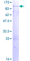 ab164691 on a 12.5% SDS-PAGE stained with Coomassie Blue.