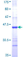 ab164692 on a 12.5% SDS-PAGE stained with Coomassie Blue.