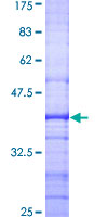ab158125 on a 12.5% SDS-PAGE stained with Coomassie Blue.