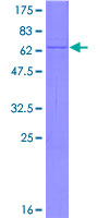 ab158210 on a 12.5% SDS-PAGE stained with Coomassie Blue.