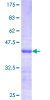 ab158220 on a 12.5% SDS-PAGE stained with Coomassie Blue.