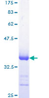 ab158130 on a 12.5% SDS-PAGE stained with Coomassie Blue.